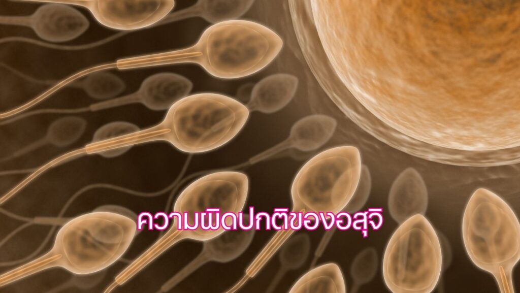 ความผิดปกติของอสุจิ